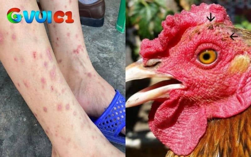 Mạt gà có nhiều tác hại đối với người và cả gia cầm Mạt gà có nhiều tác hại đối với người và cả gia cầm